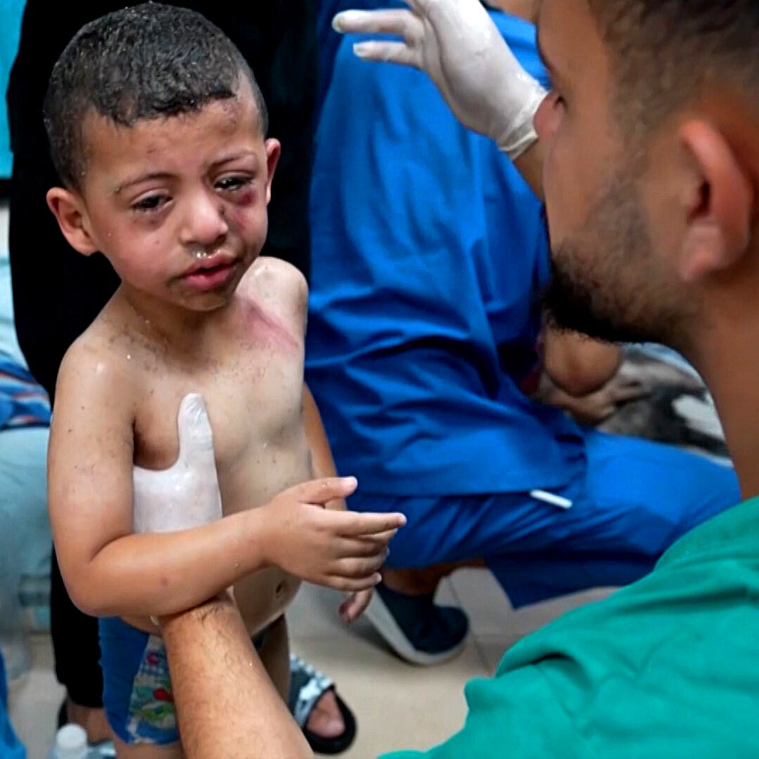 A Doctor Captures the Toll of War on Gaza’s Children